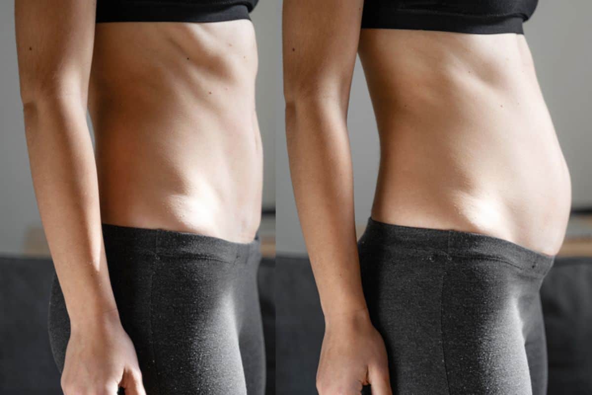 How long does diastasis recti take to improve Bournemouth?