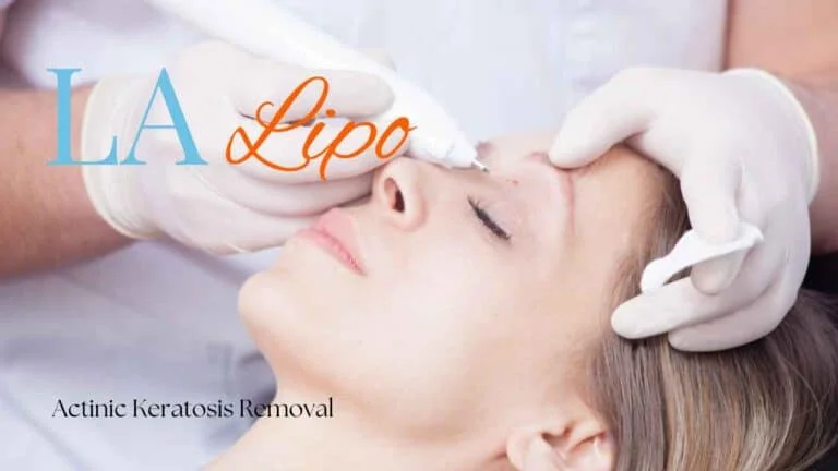 Woman receiving Actinic Keratosis Removal Treatment Bournemouth