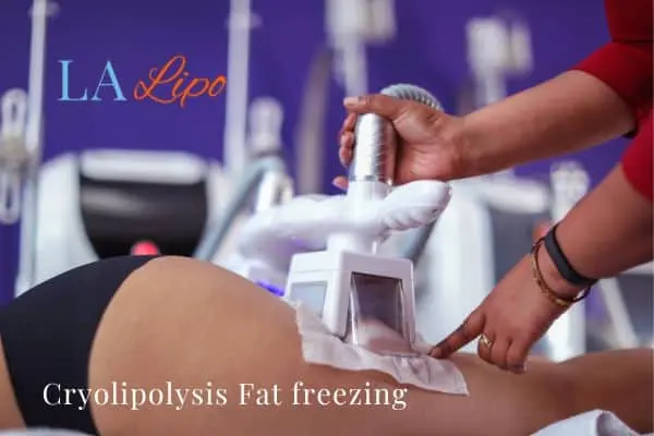 women getting fat freezing Bournemouth