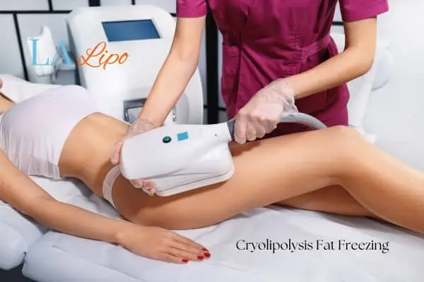 Woman receiving coolsculpting Bournemouth treatment on her thighs