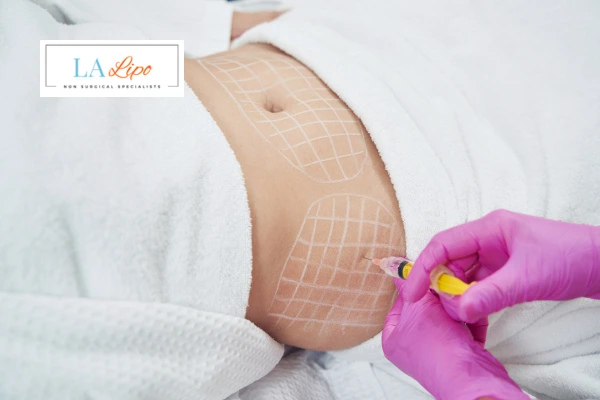 aqualyx fat dissolving injections Bournemouth