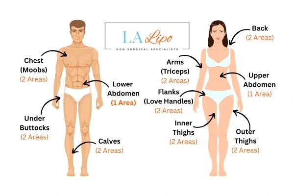 LA LIPO Cryolipolysis Areas Bournemouth