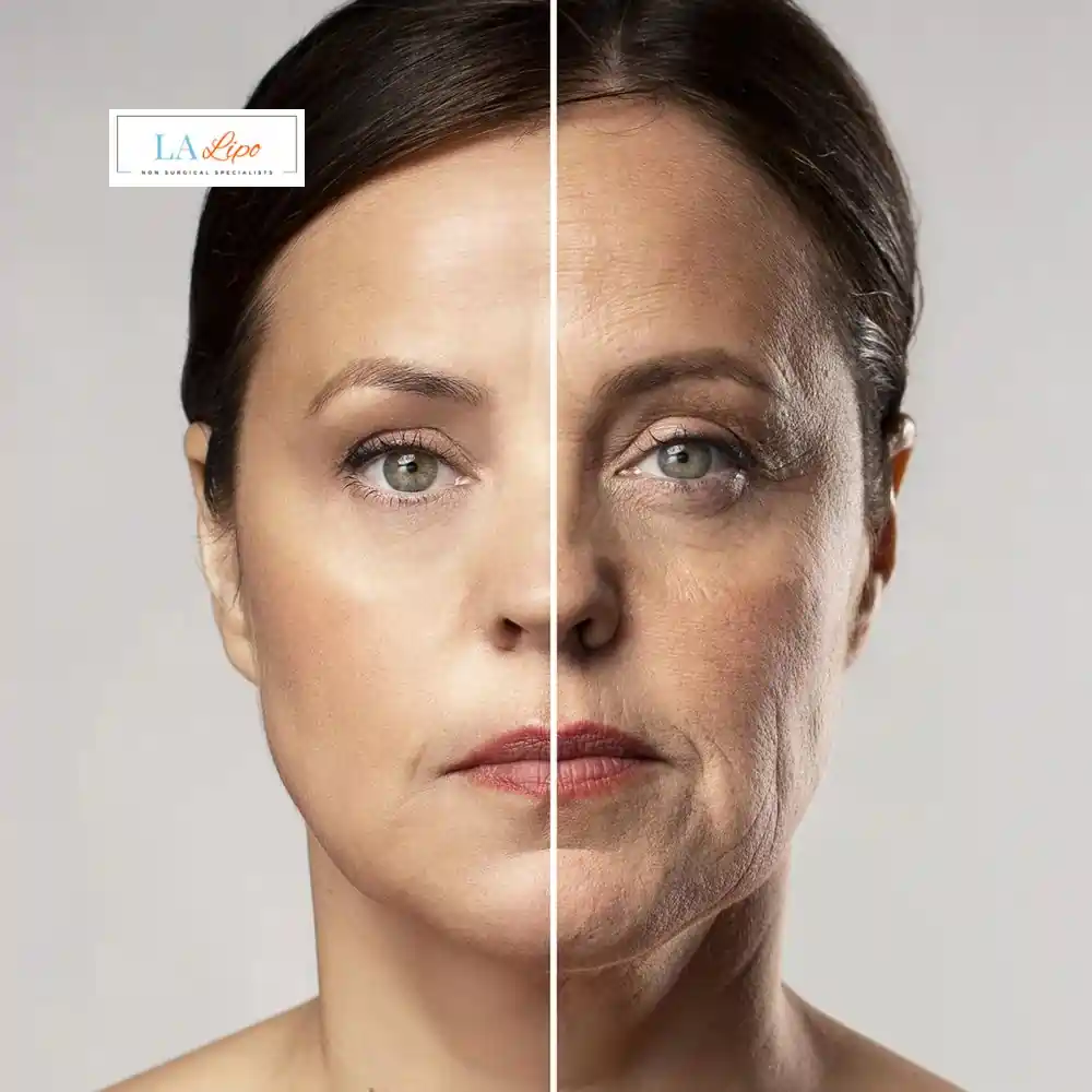 How Can You Tell If Non-Surgical Skin Tightening Is Right for You Bournemouth?