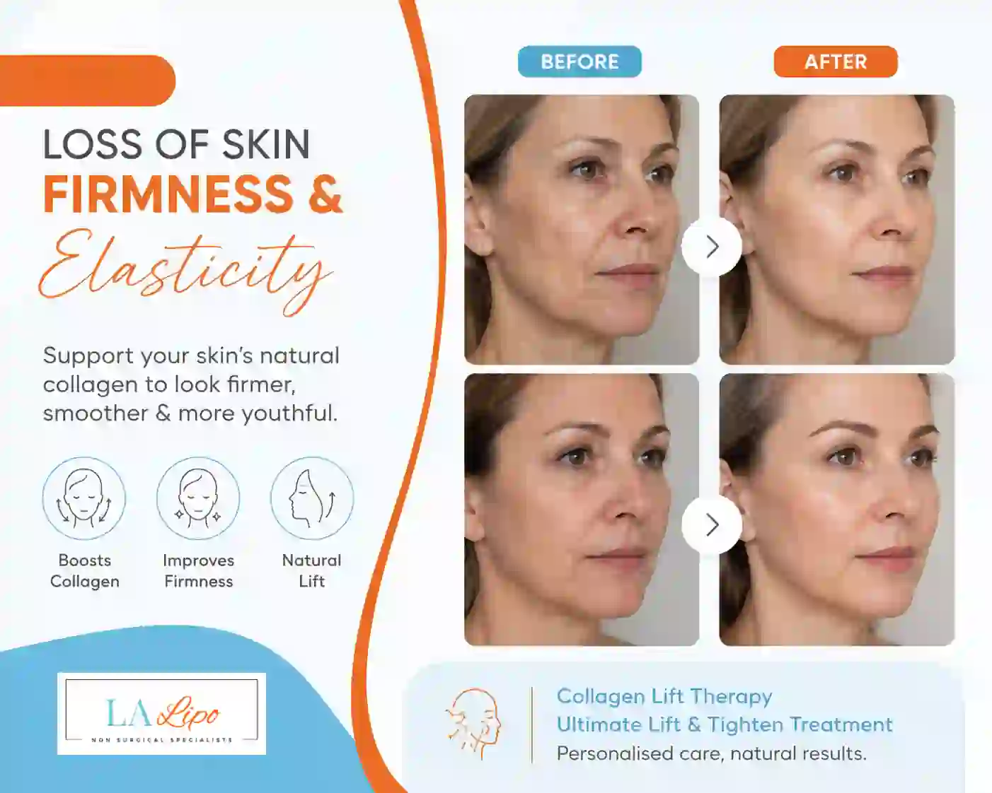 Sign #7: Loss of Skin Firmness and Elasticity Bournemouth